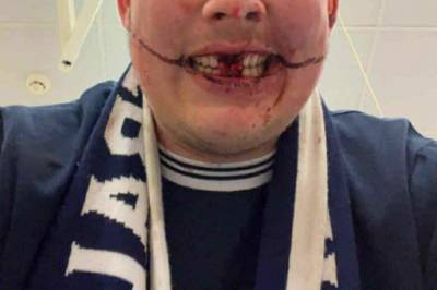 Feiret seriegull da alt ble svart: – Husker ingenting