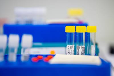 Slår tilbake mot kritikken: – Det er kjempeviktig