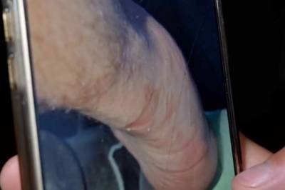 Skadet i flere uker: – Så ikke bra ut
