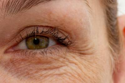 Hudlegen avslører: Disse er mest utsatt for å få rynker