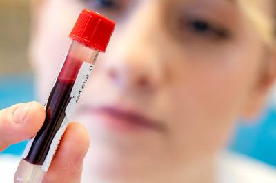 Forskning: En blodtest kan avsløre tidlige tegn på Parkinsons i blodet