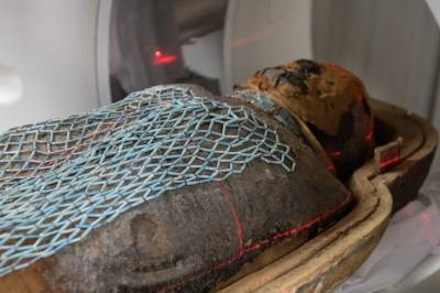 Forskere har skannet to mumier for å se hva som plaget dem