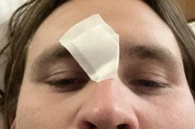 Drama på NRK-hotell