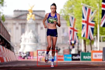 Løpestjerna ryster med skrekkbilder: – Foten eksploderte!