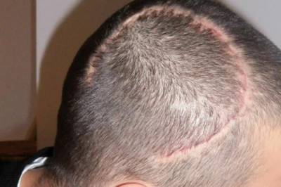 – Det var da frykten virkelig traff meg