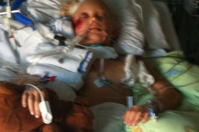 Kronikk: Som niåring fikk jeg høre at jeg kanskje aldri ville gå igjen