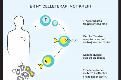 Nytt våpen mot kreft: Sender en «armé» inn i kroppen