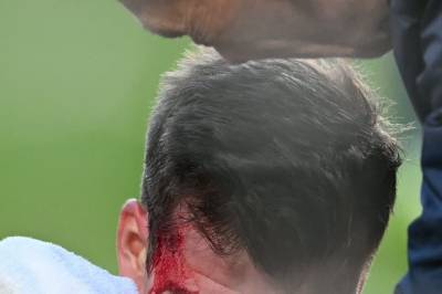 Sørloth etter smellen: - Heldigvis har jeg kjæreste og to barn