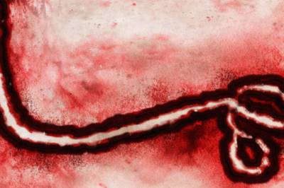 Dette er grunnen til at ebola er et av verdens dødeligste virus