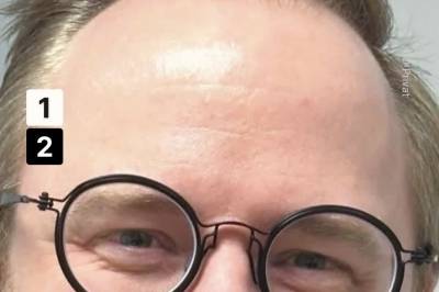 E24-nyhetene: 20.000 får høyere pensjonskostnader