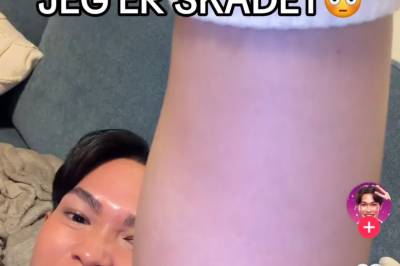 «Skal vi danse»-deltakeren skadet: – Holdt det skjult