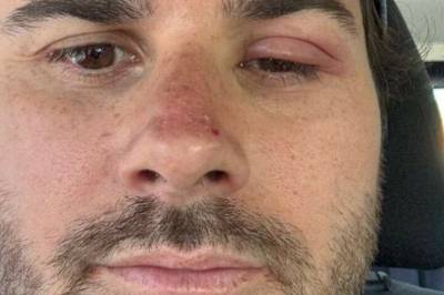 - Trengte innhold på Snapchat