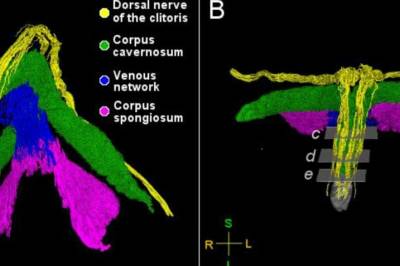 Her er første 3D-bilde av klitoris: – Mannlige og kvinnelige kjønns­organer er ganske like, sier professor