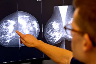 Kunstig intelligens revolusjonerer jakten på brystkreft