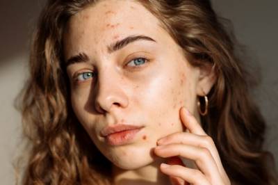 - Dette produktet er helt klart det beste mot «voksenkviser»