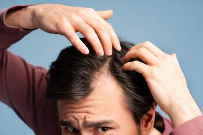 Spesielt én i familien avgjør om du mister håret – og det er ikke faren din