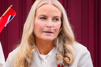 Lunge­transplantasjon: – Siste utvei