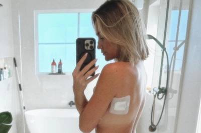 Tidligere «Frøken Norge»-vinner: – Har fått kreft