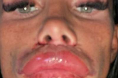 Deler nye sjokkbilder