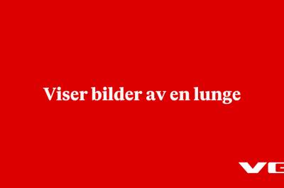 Viser bilder av en lunge