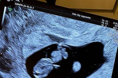 Nesten halvparten positiv til surrogati i Norge: 