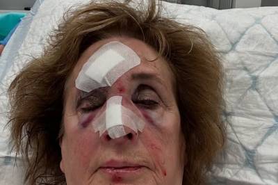 Trude Drevland deler sjokkbilde fra sykesengen