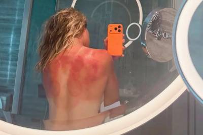 Deler skrekkbilder: – Ingen spøk