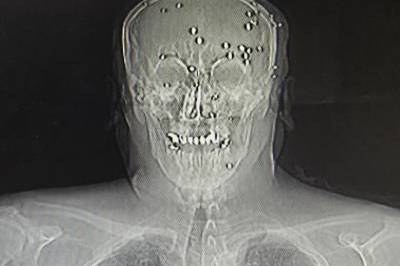 66 timer i helvete: – Jeg sover fremdeles ikke om natten