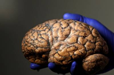 Sabler ned studier om mikroplast i kroppen: – En vits