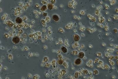 Giftige alger inntar Oslofjorden