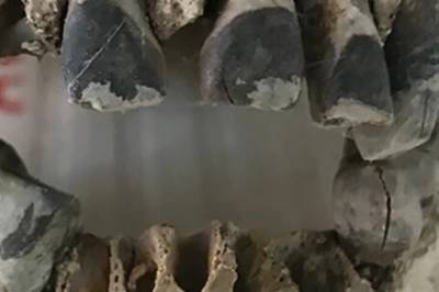 Hvite tenner har ikke alltid vært på moten