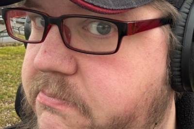 Fem om dagen - fikk hjerneblødning