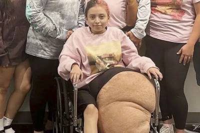 Benet veide 76 kilo