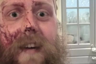 Kevin (35) angrepet: Tre pågrepet