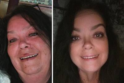 TV-profilen får massiv oppmerksomhet etter vekttapet: – Skjønner det ikke