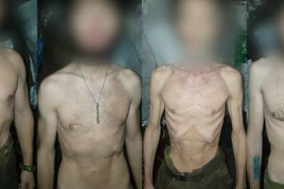 Bildene ryster:- Besvimer av sult