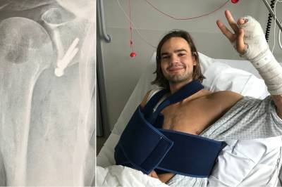 Marerittstart for ny programleiar: Skadde skuldra rett før premieren