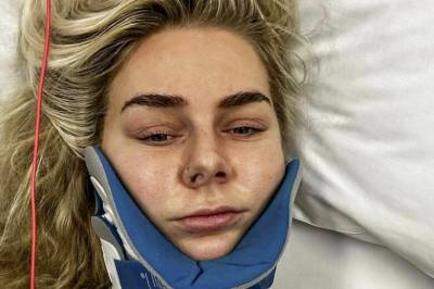 Marie (27) brakk nakken: – Hele min verden raser sammen