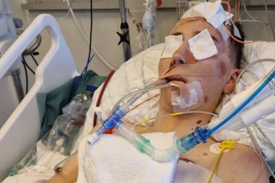 Philips mareritt på sparkesykkel: - Hjelp meg
