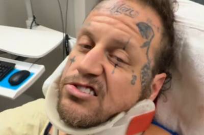 På sykehus: Hardt skadd