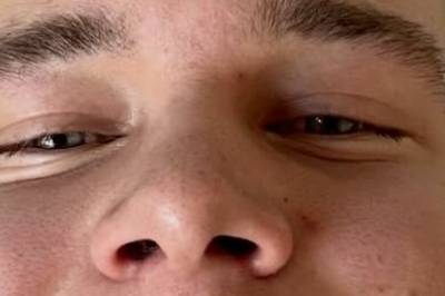 Bryter tausheten etter skrekkfallet