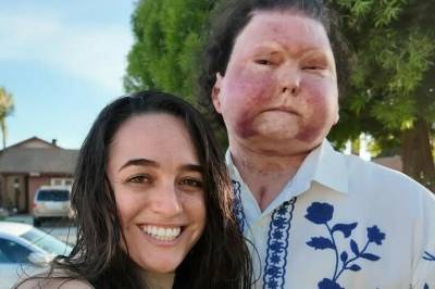 Lever med død manns ansikt