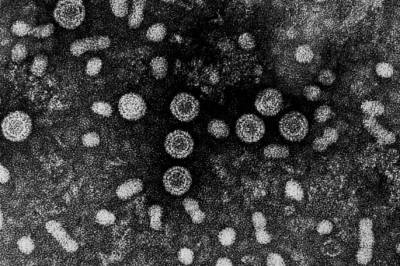 Utbrudd av hepatitt A i Europa – flere dødsfall
