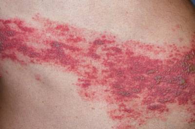 - Skaper et klasseskille