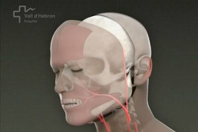 Spanske leger utførte ansikts­transplantasjon fra pasient som ventet på dødshjelp