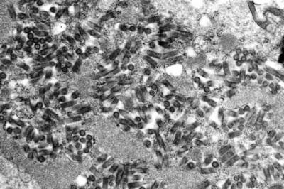 Advarer om mangel pårabiesvaksiner