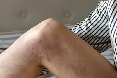 Derfor rammes kvinner oftere enn menn og dette kan du gjøre