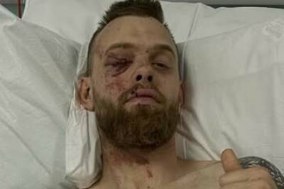 Deler bilder etter skrekkskade