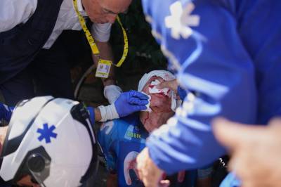 Dramatiske bilder: Tour de France-profil krasjet med bil