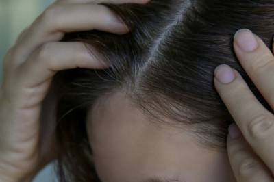 Hårtabben mange gjør nå